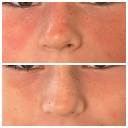 Baume Réparateur cicatrices, brûlures, irritations